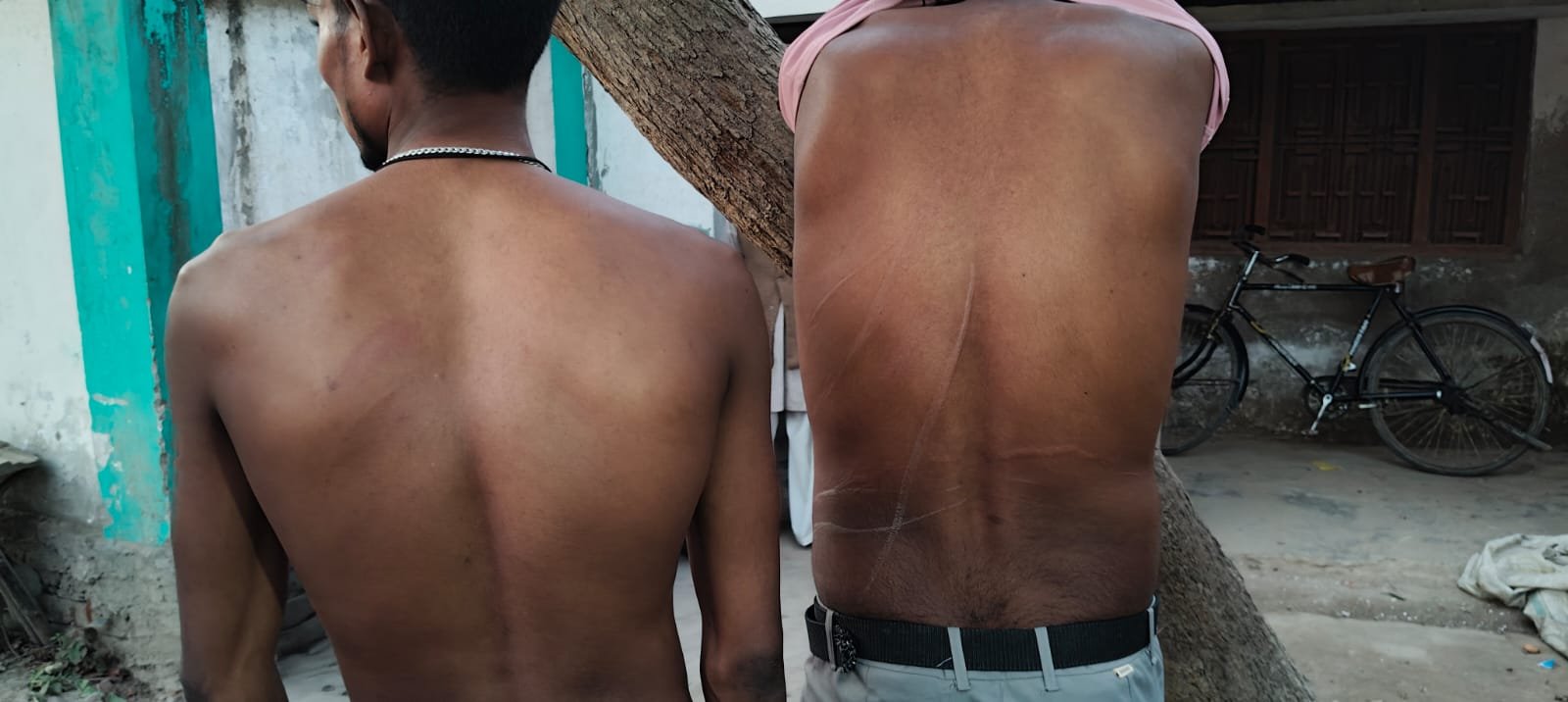 रायबरेली- दो युवकों को दबंगों ने लात घुसों वा लोहे की रॉड से मारपीट कर किया घायल