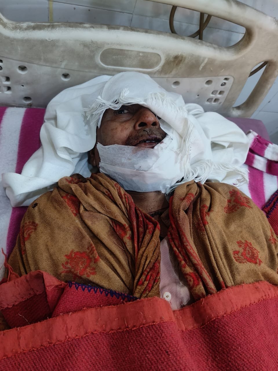 रायबरेली - देर रात घर में घुसकर दबंगों ने दम्पति पर किया जानलेवा हमला, पति गंभीर रूप से घायल