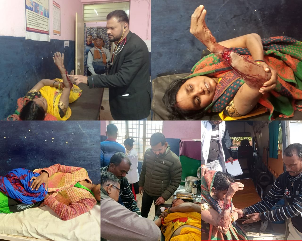 Raibareli-जमीनी विवाद में सास बहू में मारपीट , दोनों घायल