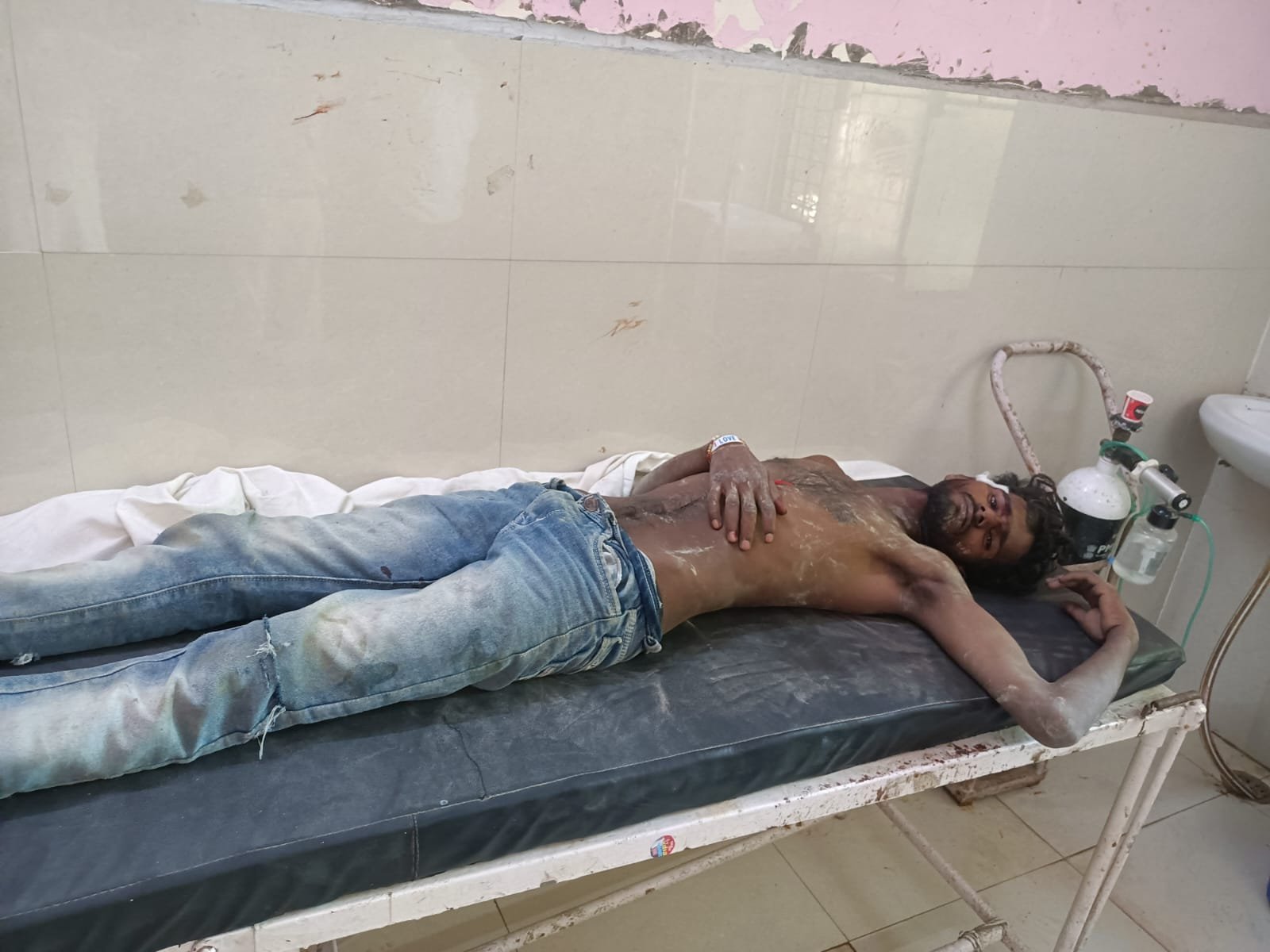 Raibareli-जमीनी विवाद में दो सगे भाइयों में मारपीट एक घायल