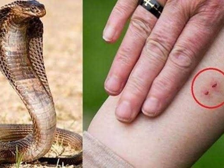Raibareli-सर्प दंश से युवक की मौत