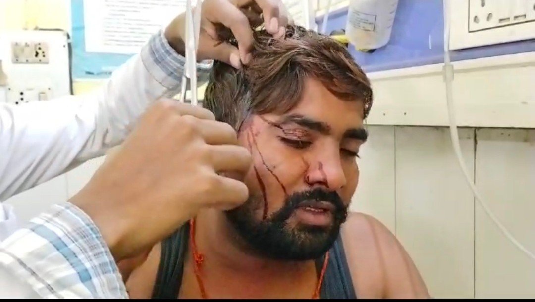 रायबरेली के कोर्ट परिसर में धारदार हथियार से युवक पर किया गया हमला