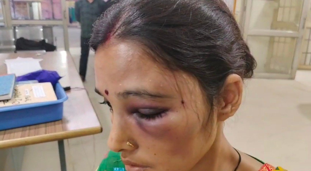 रायबरेली: शराबी पति ने पत्नी को जमकर पीटा