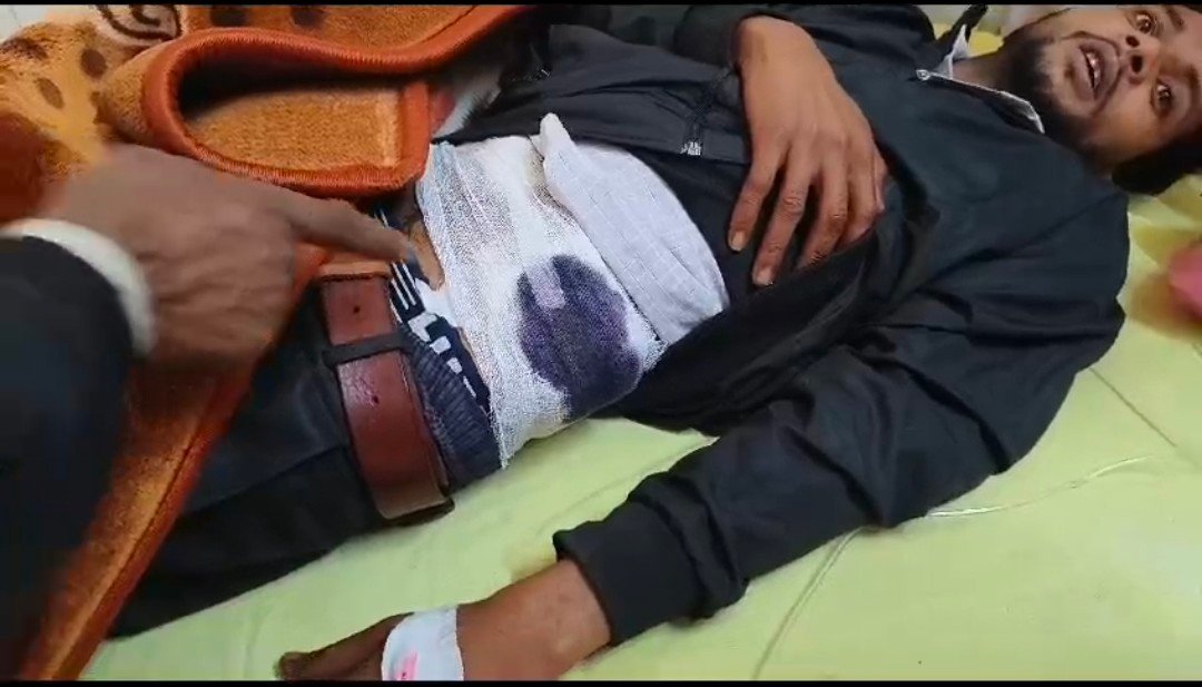 रायबरेली-प्रधान व उसके भाई पर युवक को गोली मारने का आरोप