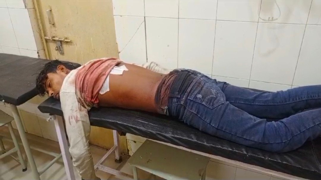 रायबरेली-युवक पर चाकुओं से हमला अज्ञात युवक ने घटना को दिया अंजाम