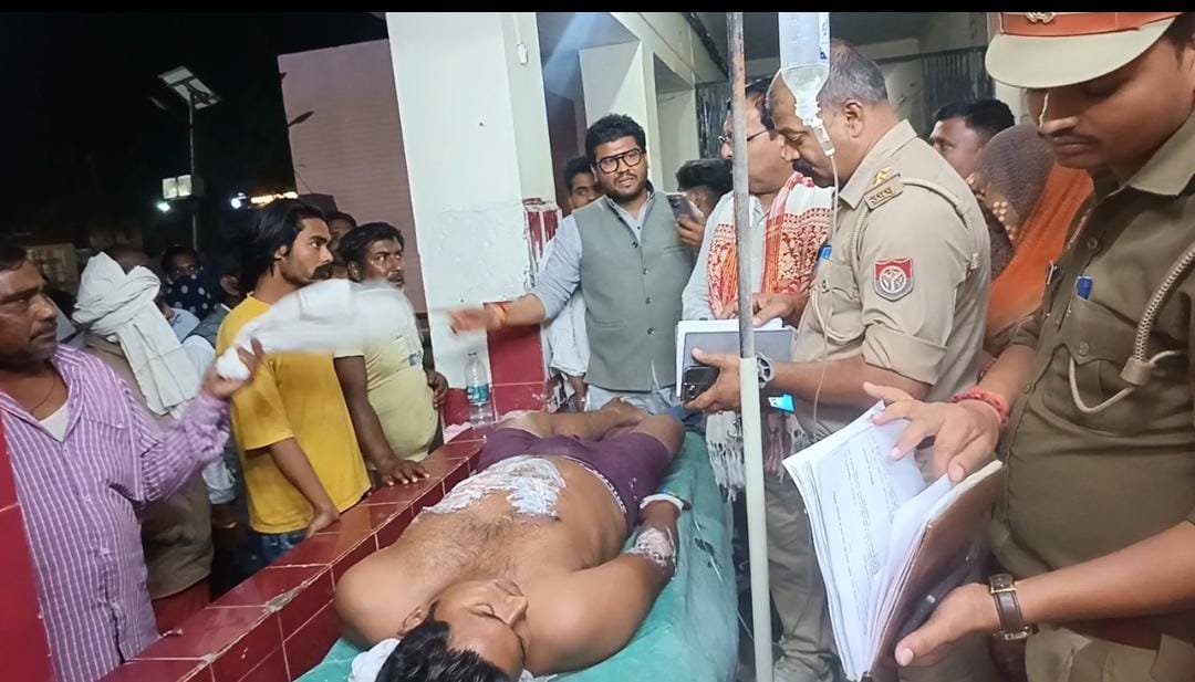 रायबरेली-दारू के लिए पैसे न देने पर दबंग ने चाचा-भतीजे पर उड़ेला खोलता तेल, एक की हालत नाजुक,,  