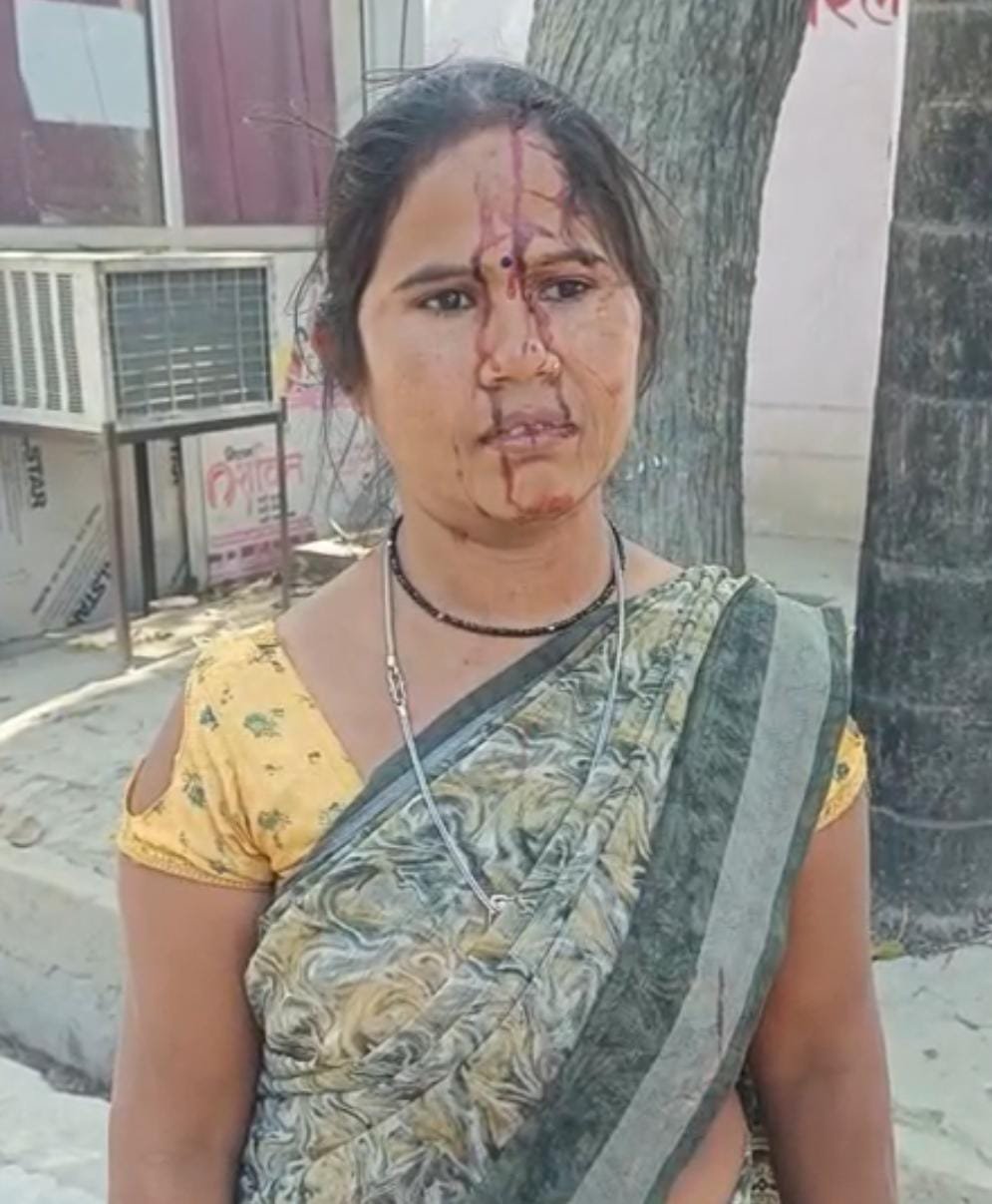 रायबरेली:विधवा महिला पर जानलेवा हमला, ससुरालियों पर मारपीट का आरोप,,,, 