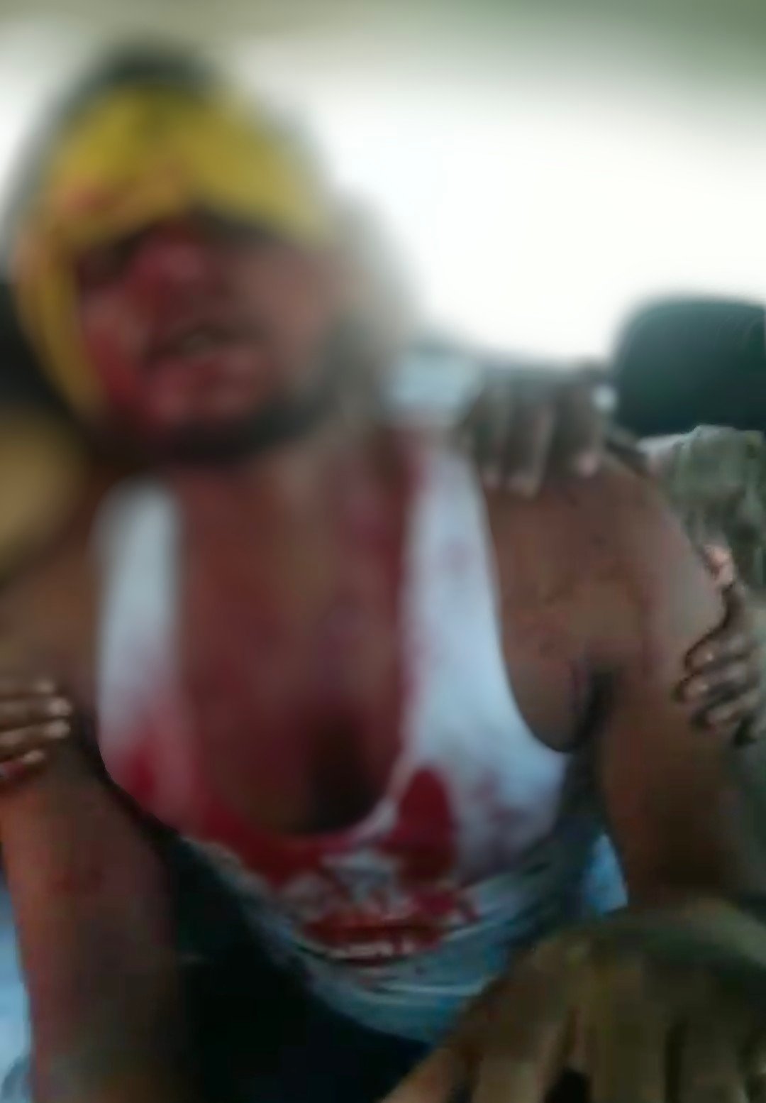 रायबरेली के घोरवारा चौकी इंचार्ज को बेखौफ दबंग दे रहे है खुलेआम चुनौती,घर मे घुसकर किया जानलेवा हमला