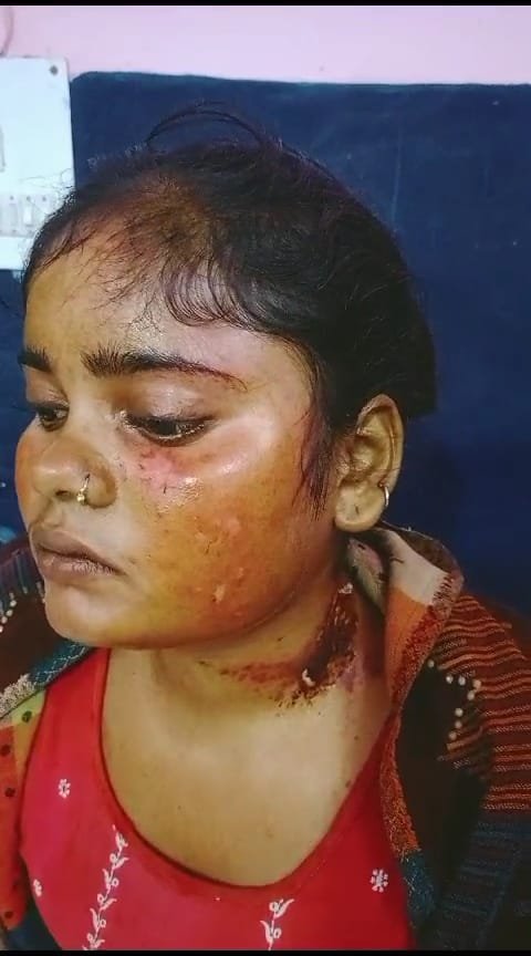 रायबरेली-बकरी चराने को लेकर हुए विवाद में किशोरी को किया लहुलुहान 