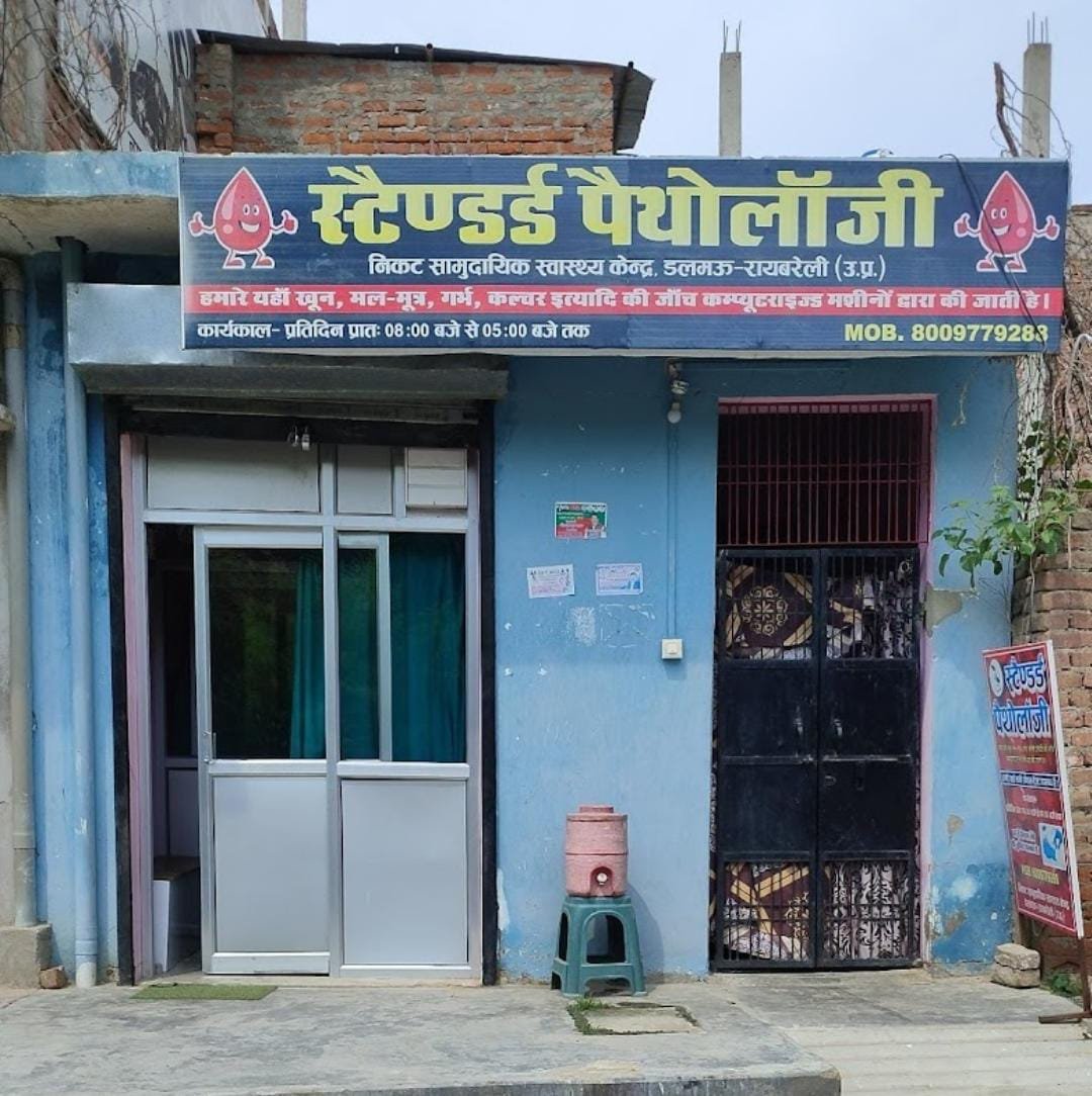 Raibareli-खबर मतलब R.Express CHC अधीक्षक ने स्टैंडर्ड पैथोलॉजी के संचालक को थमाई नोटिस