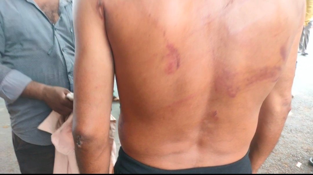 रायबरेली में गैर समुदाय के दो युवकों पर मारपीट का आरोप