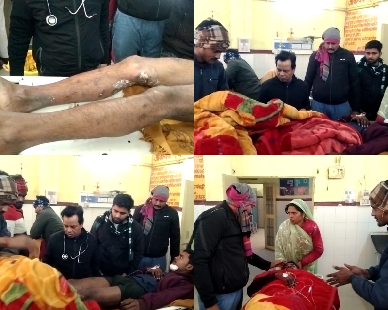 Raibareli-करंट की राम चपेट में आया युवक गंभीर,रूप से झुलसा 