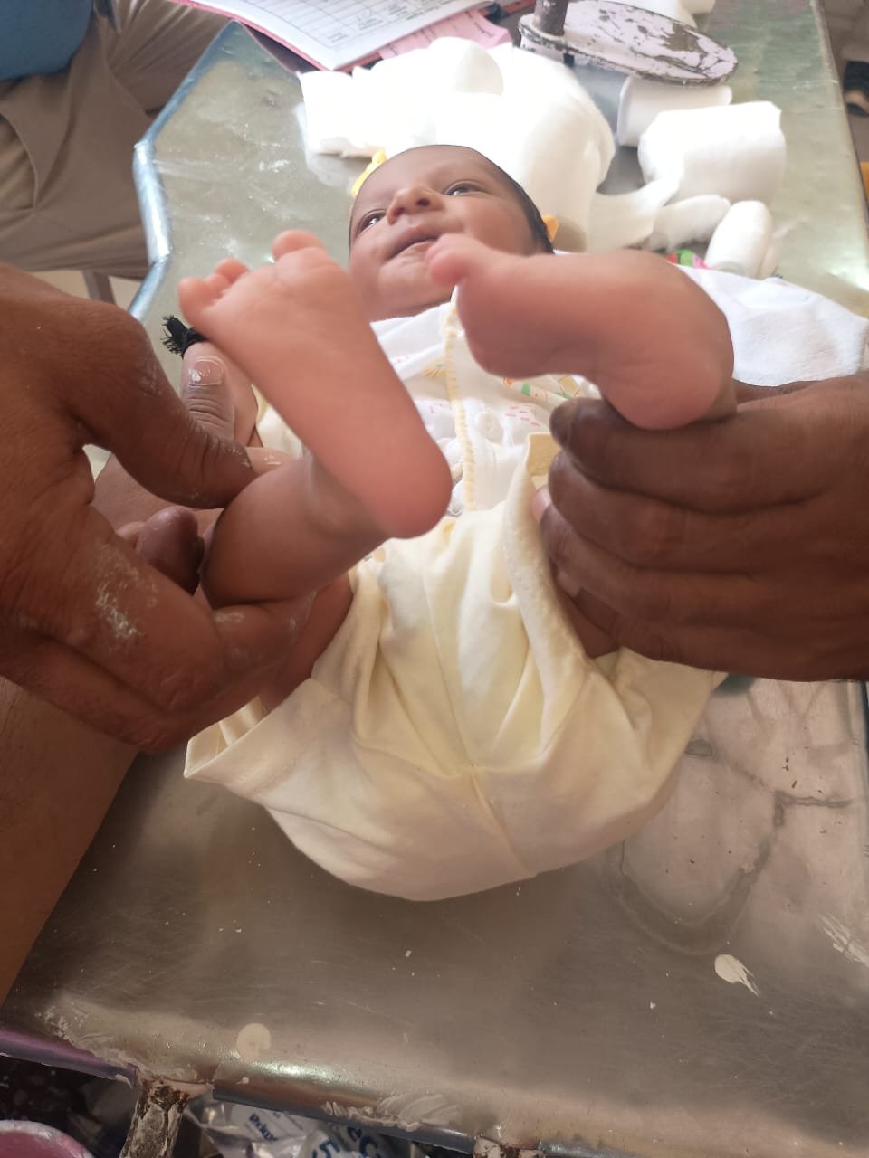 जिला चिकित्सालय रायबरेली के हड्डियों रोग विभाग के डाक्टर पीके पाल ने पेश किया मानवता का मिशाल बने जन्मजात लड़खड़ाते कदमो का सहारा 