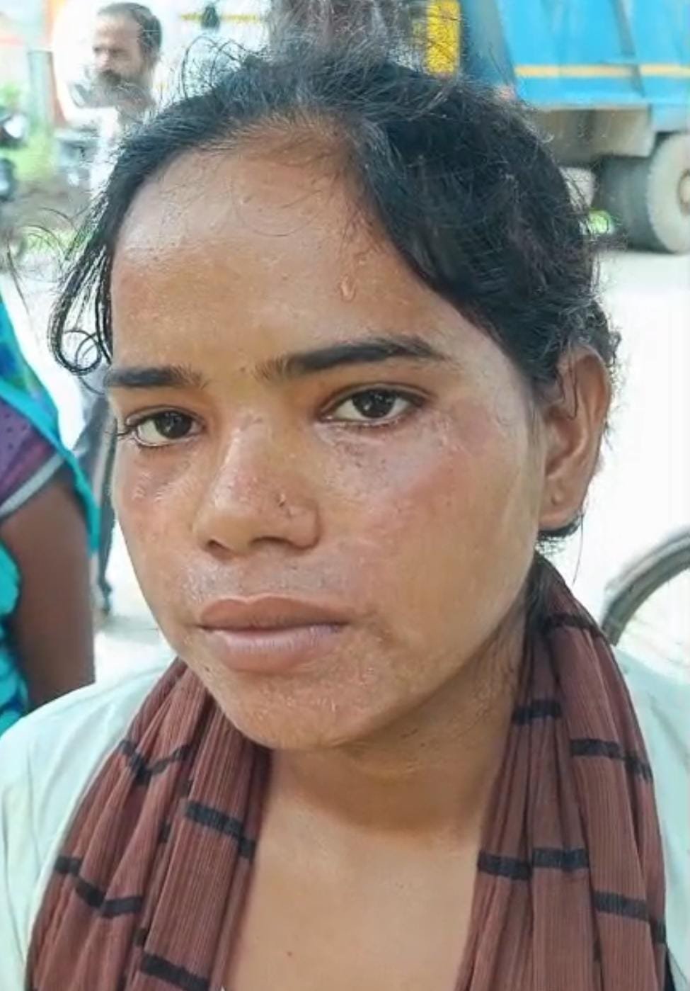 रायबरेली-एक युवती को उसके सगे भाई और भाभी ने मारपीट कर किया घायल,,,, 