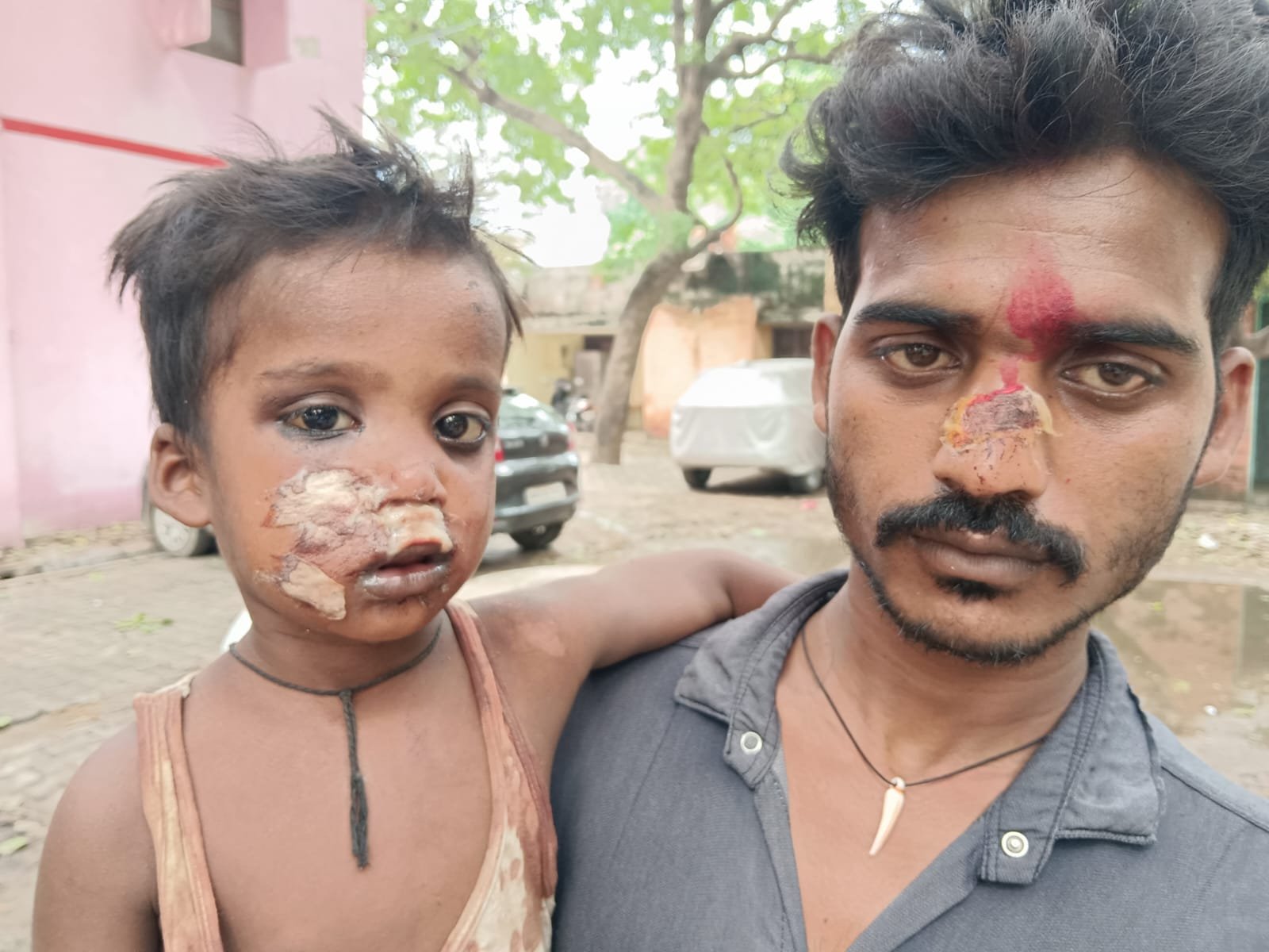 Raibareli-आपसी विवाद पर मारपीट का लगाया आरोप 