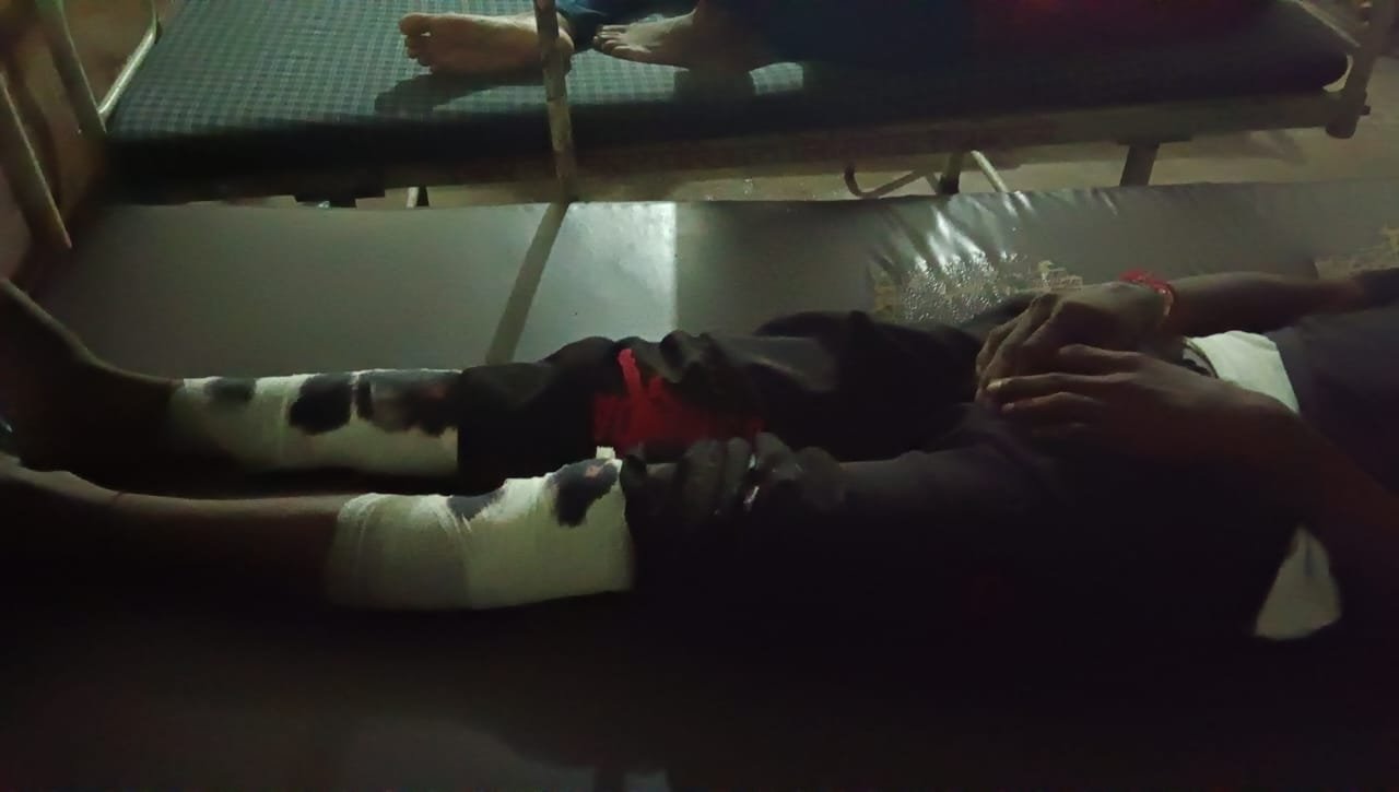 Raibareli-रायबरेली में दो बाइको की आमने सामने भीषण टक्कर