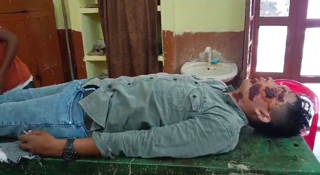 Raibareli-आमने-सामने की टक्कर हैं युवक गंभीर रूप से घायल 