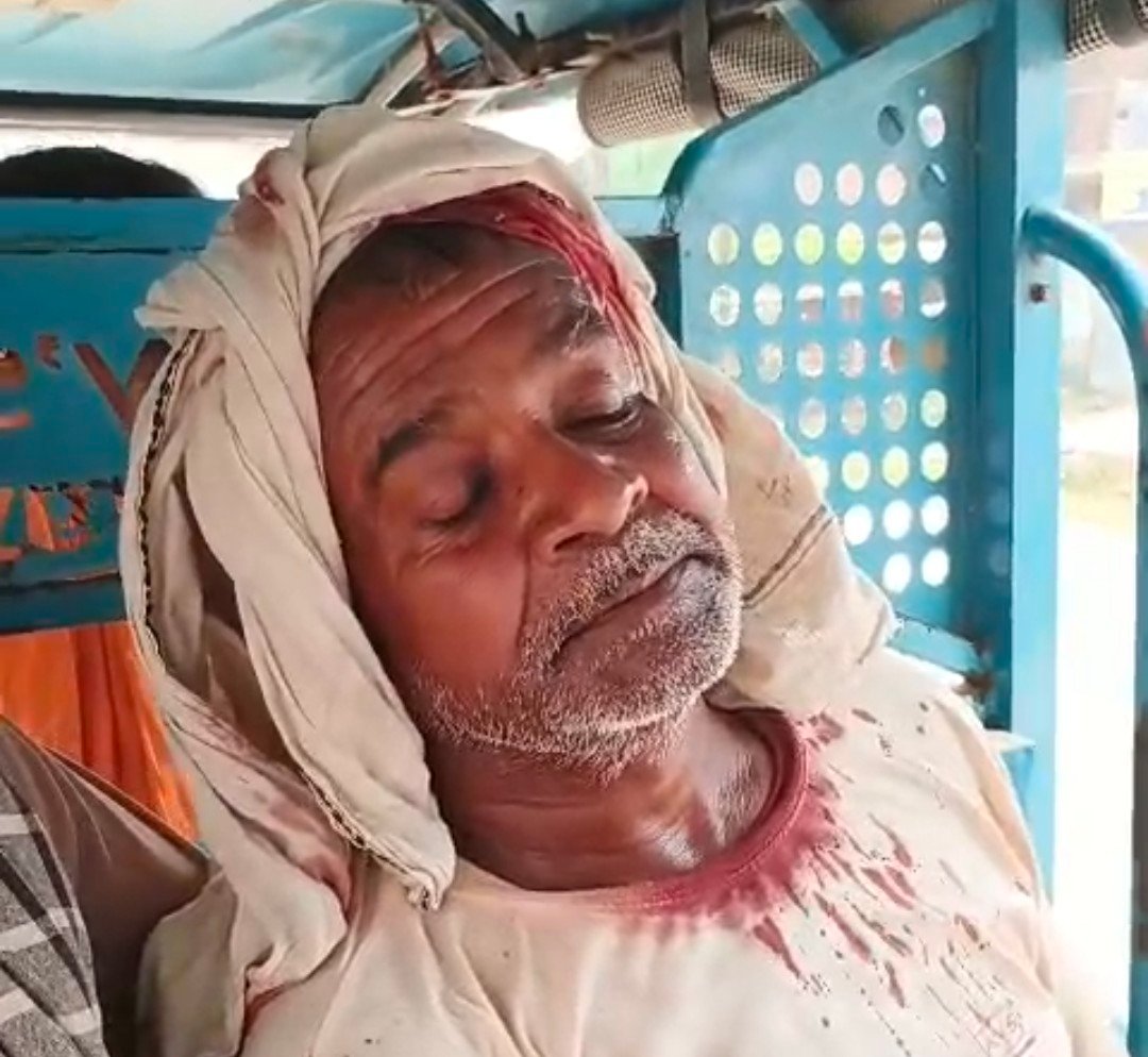 रायबरेली-पुरानी रंजिश को लेकर दंबगो ने धारदार हथियार से किया जनलेवा हमला