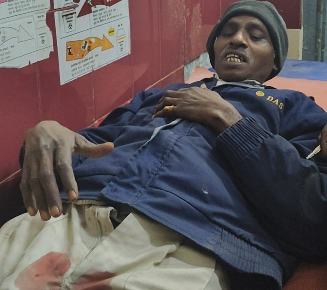 रायबरेली- एक अनियंत्रित तेज रफ्तार कार ने दो साइकिल सवार मजदूरों को मारी टक्कर,दो घायल