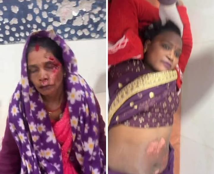 रायबरेली-टोल प्लाजा के निकट अज्ञात वाहन ने ई रिक्शा में मारी टक्कर, तीन महिलाएं घायल 