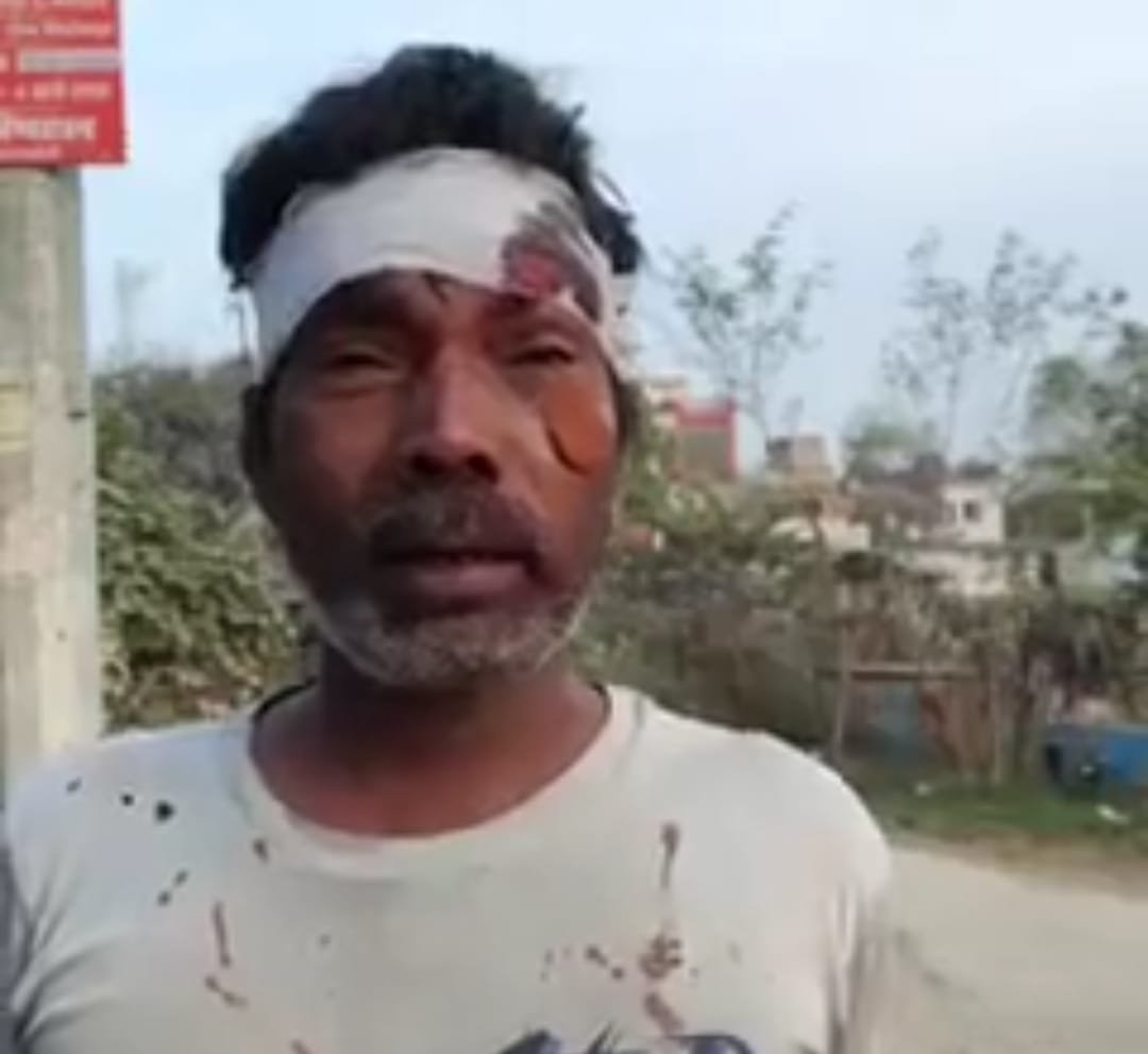 रायबरेली-ऊंचाहार:मजदूरी के पैसे मांगने पर राजमिस्त्री की बेरहमी से पिटाई,अस्पताल में भर्ती,,,, 