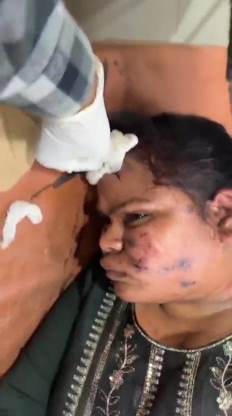 रायबरेली-जनरेटर की चपेट में आने से युवती गंभीर रूप से हुई घायल