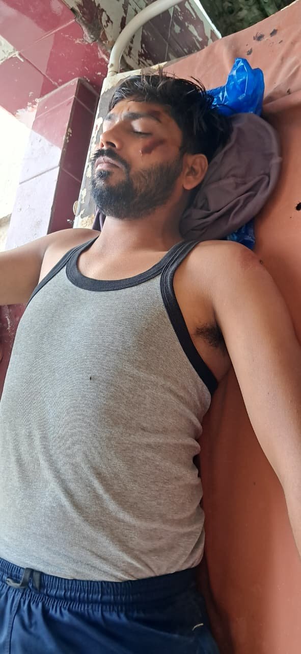 रायबरेली:तेज रफ्तार चार पहिया वाहन ने मारी जोरदार टक्कर एक घायल,,,, 