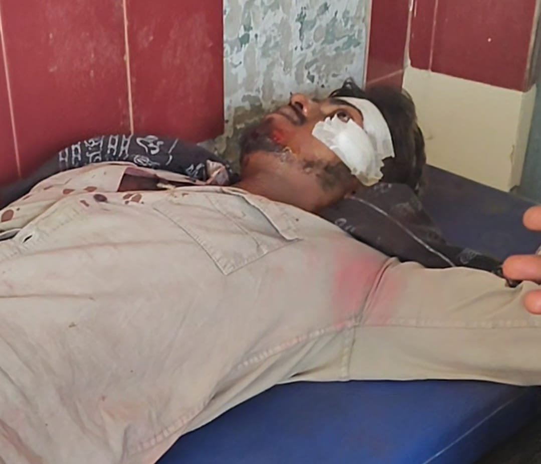 ऊंचाहार:नशे में धुत युवकों की बाइक पेड़ से टकराई, दो घायल,,,,, 