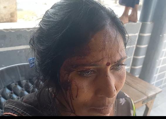 रायबरेली-महिला ने लगाया पड़ोसियों पर मारपीट का आरोप