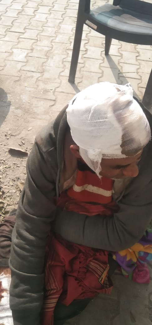 Raibareli-मोटर सायकिल ट्रांसफर करने के विवाद में बड़े भाई ने छोटे भाई को कुल्हाड़ी मारकर घायल किया।