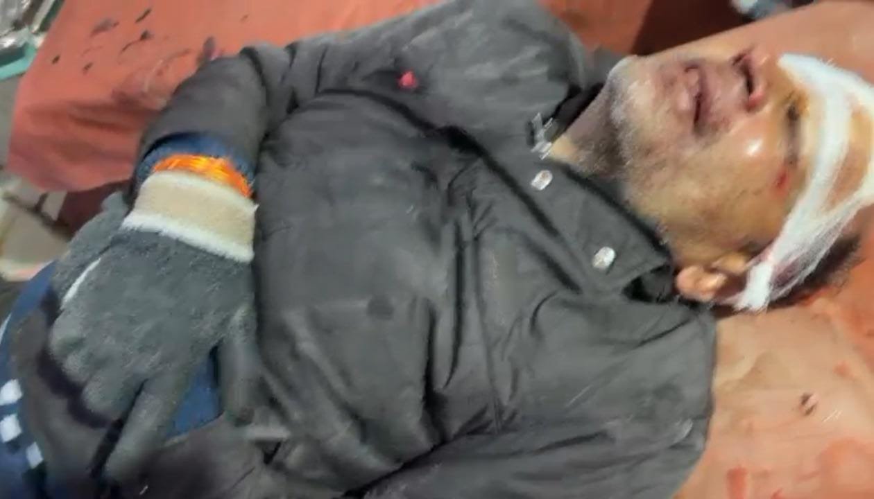 रायबरेली - मॉर्निंग वॉक पर निकले अधेड़ को अज्ञात बाइक सवार ने मारी टक्कर, रेफर