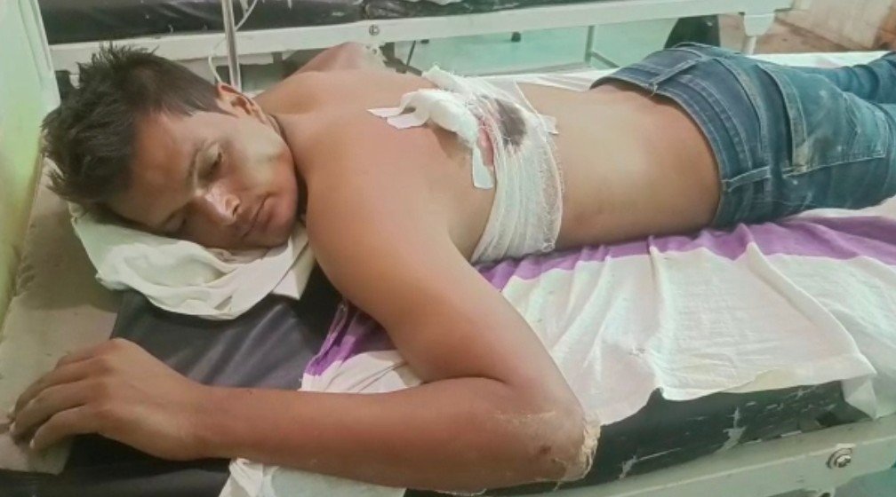 Raibareli-दबंगो ने युवक को मारी गोली