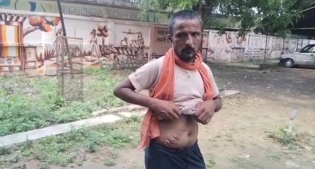 पैर की जगह मरीज के पेट का ऑपरेशन करने का लगा आरोप