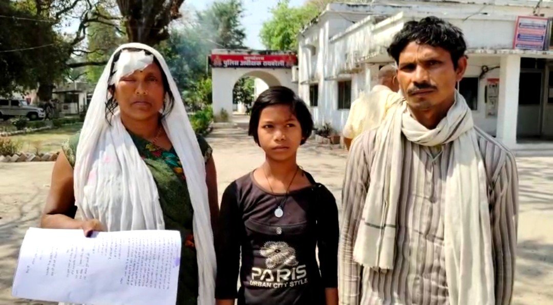 Raibareli-बेलगाम हुए दबंग, दबंगो ने महिला को बेरहमी से पीटा