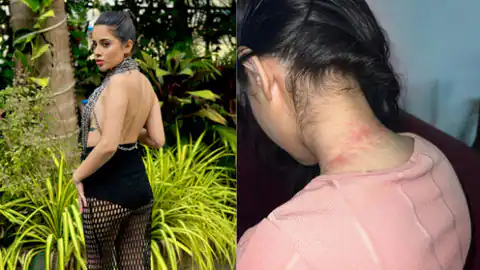 बोल्ड दिखने के लिए हर हद तक गुजर जाती हैं उर्फी जावेद, फोटो में देखें क्या हो गया एक्ट्रेस का हाल