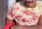 तेज रफ्तार अनियंत्रित डीसीएम व छोटा हाथी की हुई टक्कर, चालक गंभीर रूप से घायल