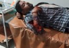 रायबरेली रास्ता भटक जाने से युवक सड़क दुर्घटना का हुआ शिकार, गंभीर हालत में रेफर