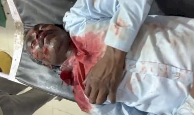 रायबरेली अज्ञात वाहन की टक्कर से बाइक सवार घायल, हालत गंभीर