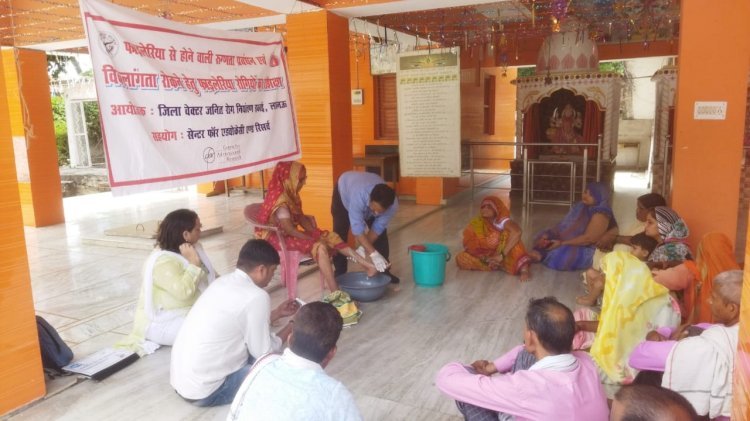 फाइलेरिया सपोर्ट ग्रुप के सदस्यों को किया गया प्रशिक्षित