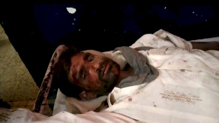 रायबरेली-सड़क हादसे में बाइक सवार गंभीर रूप से घायल हालत नाजुक