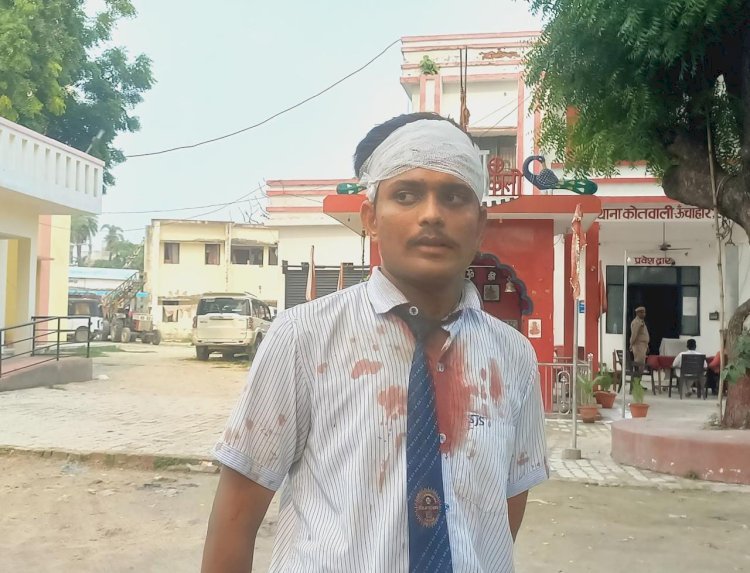 रायबरेली-एक दर्जन हमलावरों ने असलहे के बट से छात्र को पीटा,,,
