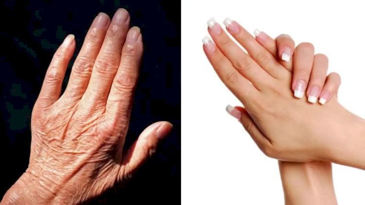 हाथों में झुर्रिया देख लोग समझ न ले बूढ़ा करे ये उपाय!