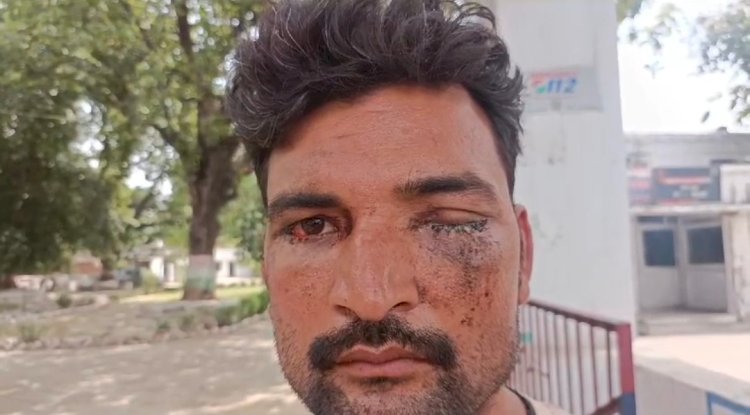 Raibareli-भाई बना भाई का दुश्मन वारदात को दिया अंजाम