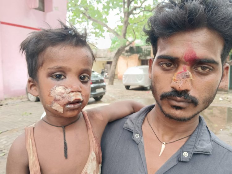 Raibareli-आपसी विवाद पर मारपीट का लगाया आरोप