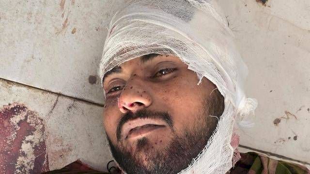 यूपी में फिर पुलिस एनकाउंटर, मारा गया डेढ़ लाख का इनामी राजेश; इंस्पेक्टर और सिपाही को भी लगी गोली