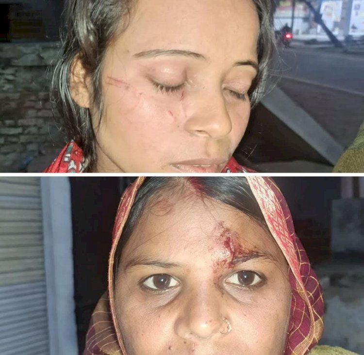 रायबरेली- दबंगों नें नन्द और भाभी को पीटकर कर किया घायल, पुलिस नहीं कर रही कोई कार्यवाही,,,,