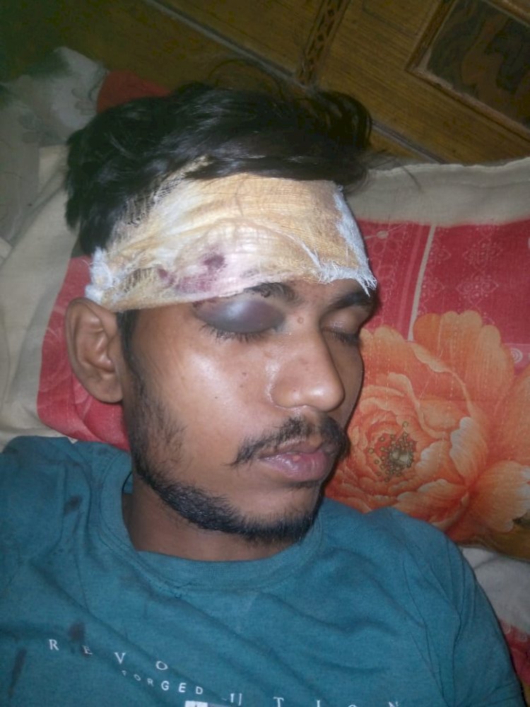 रायबरेली में तो क्या कानून का इकबाल बुलंद करने में फिसड्डी साबित हो रही गदागंज पुलिस