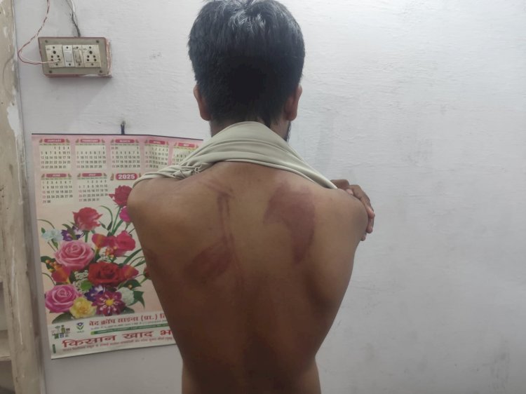 रायबरेली-सिटीजन पब्लिक स्कूल में पढ़ने वाले छात्र को टीचर ने दी थर्ड डिग्री