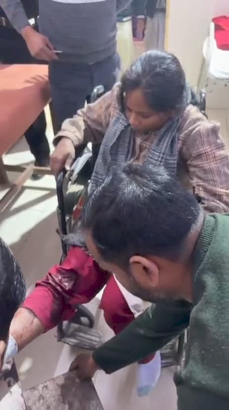 रायबरेली-अज्ञात रिक्शा की टक्कर से युवती घायल, रेफर