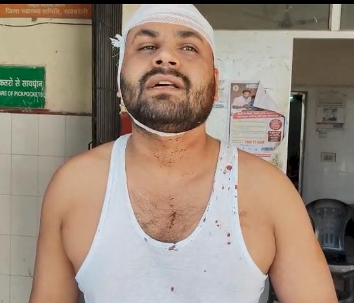 रायबरेली-ऊंचाहार:इटौरा बुजुर्ग में पानी के विवाद को लेकर खूनी संघर्ष,दोनों पक्षों के कई लोग घायल,,, 